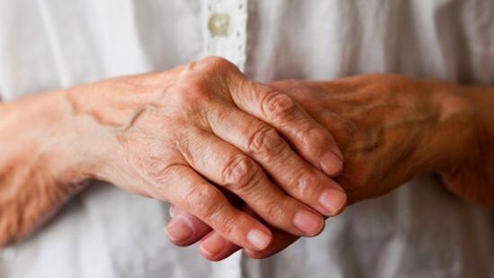 Reimatoīdais artrīts izraisa sāpes un pietūkumu pirkstu locītavās. 